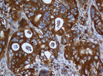 CAPN2 Antibody in Immunohistochemistry (Paraffin) (IHC (P))