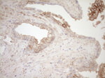 CAPN5 Antibody in Immunohistochemistry (Paraffin) (IHC (P))