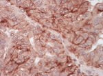 CAR Antibody in Immunohistochemistry (IHC)