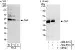 CAR Antibody in Western Blot (WB)