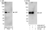 CAR Antibody in Western Blot (WB)