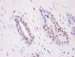 CARM1 Antibody in Immunohistochemistry (IHC)