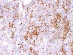 CARM1 Antibody in Immunohistochemistry (IHC)