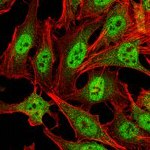 PRMT4 Antibody in Immunocytochemistry (ICC/IF)