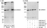 CARMA1 Antibody in Western Blot (WB)