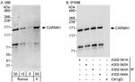 CARMA1 Antibody in Western Blot (WB)