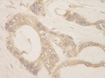 CASC3 Antibody in Immunohistochemistry (IHC)