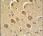 Caspase 3 (Cleaved Asp175) Antibody in Immunohistochemistry (IHC)