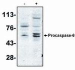 Caspase 6 Antibody in Western Blot (WB)