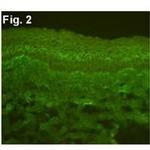 Calcium Sensing Receptor Antibody in Immunohistochemistry (IHC)