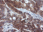 CAST Antibody in Immunohistochemistry (Paraffin) (IHC (P))