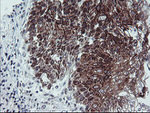 CAST Antibody in Immunohistochemistry (Paraffin) (IHC (P))