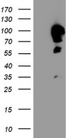 CAST Antibody in Western Blot (WB)