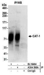 CAT-1 Antibody in Western Blot (WB)