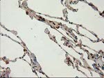 CAT Antibody in Immunohistochemistry (Paraffin) (IHC (P))