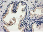 CAT Antibody in Immunohistochemistry (Paraffin) (IHC (P))