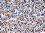 CAT Antibody in Immunohistochemistry (Paraffin) (IHC (P))