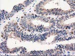 CAT Antibody in Immunohistochemistry (Paraffin) (IHC (P))