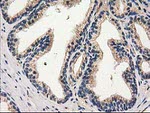 CAT Antibody in Immunohistochemistry (Paraffin) (IHC (P))