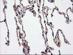 CAT Antibody in Immunohistochemistry (Paraffin) (IHC (P))