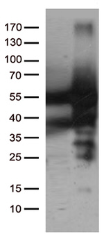 CAT Antibody in Western Blot (WB)