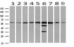 CAT Antibody in Western Blot (WB)