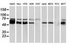 CAT Antibody in Western Blot (WB)