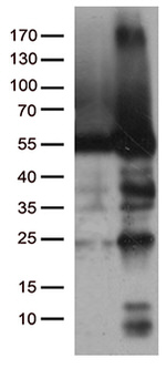 CAT Antibody in Western Blot (WB)