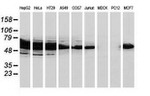 CAT Antibody in Western Blot (WB)