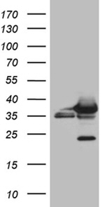 CBR1 Antibody in Western Blot (WB)