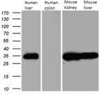 CBR1 Antibody in Western Blot (WB)