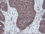 CBR3 Antibody in Immunohistochemistry (Paraffin) (IHC (P))