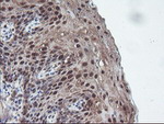 CBR3 Antibody in Immunohistochemistry (Paraffin) (IHC (P))