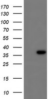 CBR3 Antibody in Western Blot (WB)