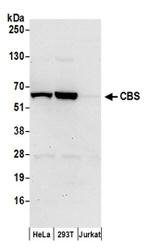 CBS Antibody in Western Blot (WB)