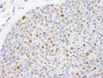 CBX5 Antibody in Immunohistochemistry (IHC)