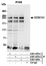 CCDC131 Antibody in Western Blot (WB)