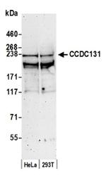 CCDC131 Antibody in Western Blot (WB)