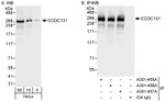 CCDC131 Antibody in Western Blot (WB)