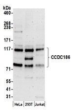 CCDC186 Antibody in Western Blot (WB)