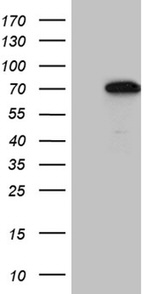 CCDC22 Antibody in Western Blot (WB)