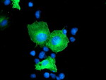 CCM2 Antibody in Immunocytochemistry (ICC/IF)