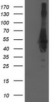 CCM2 Antibody in Western Blot (WB)