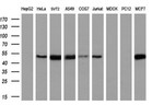 CCM2 Antibody in Western Blot (WB)