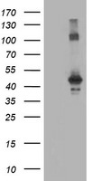 CCM2 Antibody in Western Blot (WB)