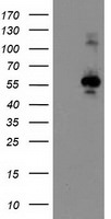 CCM2 Antibody in Western Blot (WB)