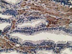 CCNB1IP1 Antibody in Immunohistochemistry (Paraffin) (IHC (P))