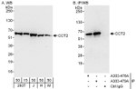 CCT2 Antibody in Western Blot (WB)