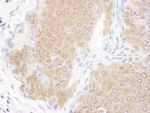 CCT3 Antibody in Immunohistochemistry (IHC)