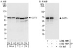 CCT3 Antibody in Western Blot (WB)